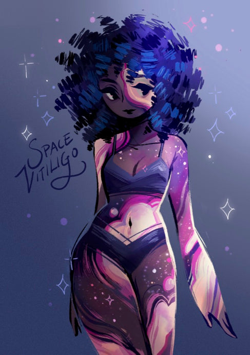 Space Vitiligo Print